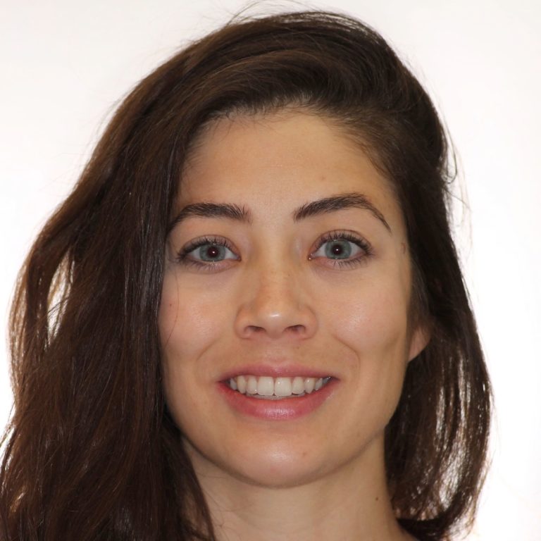 Patient portrait smiling after treatment