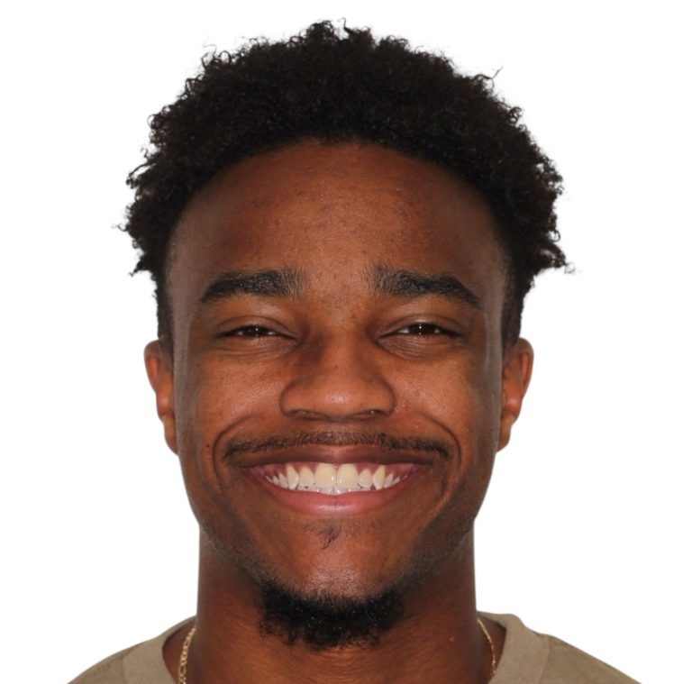 Patient portrait smiling after treatment